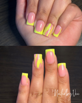 🍋 Neon Lemon Drip